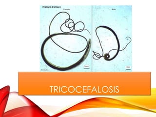 TRICOCEFALOSIS
 