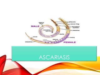 ASCARIASIS
 