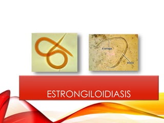 ESTRONGILOIDIASIS
 