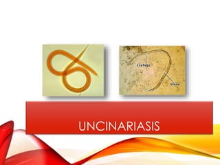 UNCINARIASIS
 
