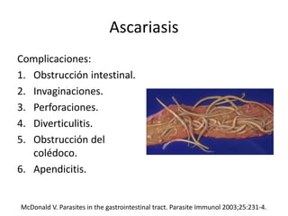 Ascariasis
Complicaciones:
1. Obstrucción intestinal.
2. Invaginaciones.
3. Perforaciones.
4. Diverticulitis.
5. Obstrucción del
colédoco.
6. Apendicitis.
McDonald V. Parasites in the gastrointestinal tract. Parasite Immunol 2003;25:231-4.
 