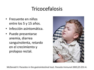 Tricocefalosis
• Frecuente en niños
entre los 5 y 15 años.
• Infección asintomática.
• Puede presentarse
anemia, diarrea
sanguinolenta, retardo
en el crecimiento y
prolapso rectal.
McDonald V. Parasites in the gastrointestinal tract. Parasite Immunol 2003;25:231-4.
 