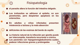 Fisiopatologia
● el parasito altera la función del intestino delgado.
● Los trofozoítos se adhieren al epitelio, no son
penetrantes, pero despiertan apoptosis en los
enterocitos.
● En adultos y niños infectados presentan
intolerancia a lactosa y la mala absorción
● deficientes de las enzimas del borde de cepillo
● La historia natural de la infección por giardia puede
ser interrumpida, transitoria recurrente o crónica.
● Los pacientes con hipogammaglobulinemia suelen
padecer infecciones graves y prolongadas
 