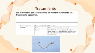 Tratamiento
 