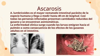 Ascarosis
● A. lumbricoides es el mayor nematodo intestinal parásito de la
especie humana y llega a medir hasta 40 cm de longitud. Casi
todas las personas infectadas presentan cantidades reducidas del
gusano y se encuentran asintomáticas.
● La enfermedad clínica surge cuando las larvas emigran hacia el
pulmón o como consecuencia de los efectos de los gusanos
adultos en el intestino.
 