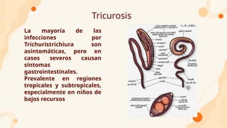 Tricurosis
La mayoría de las
infecciones por
Trichuristrichiura son
asintomáticas, pero en
casos severos causan
síntomas
gastrointestinales.
Prevalente en regiones
tropicales y subtropicales,
especialmente en niños de
bajos recursos
 