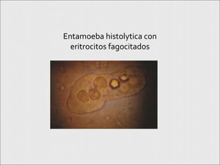 Entamoeba histolytica con
eritrocitos fagocitados
 