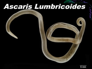 Ascaris Lumbricoides

 