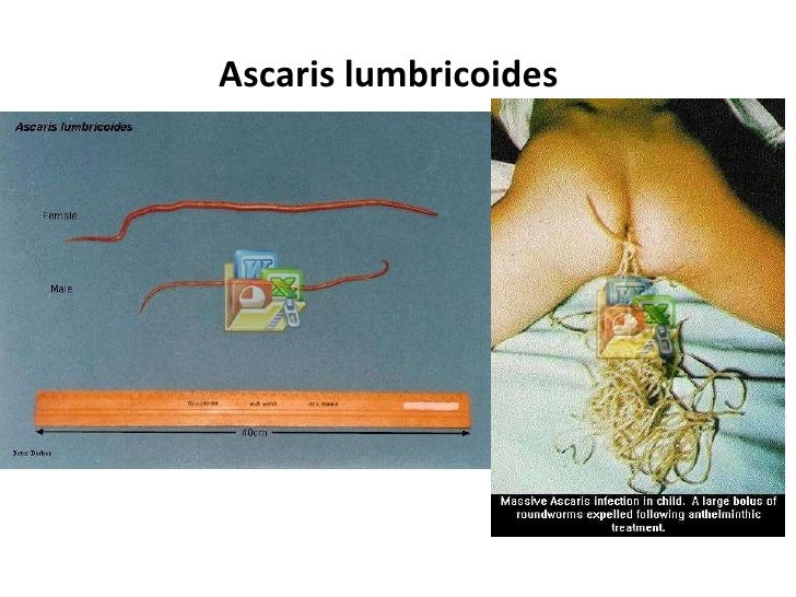 A los gatitos 1 mes las lombrices