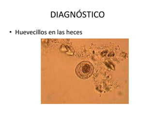 DIAGNÓSTICO
• Huevecillos en las heces
 