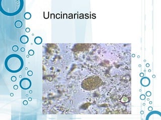 Uncinariasis
 
