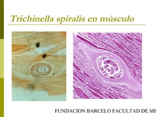 FUNDACION BARCELO FACULTAD DE ME
Trichinella spiralis en músculo
 