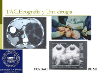 FUNDACION BARCELO FACULTAD DE ME
TAC,Ecografía y Una cirugía
 