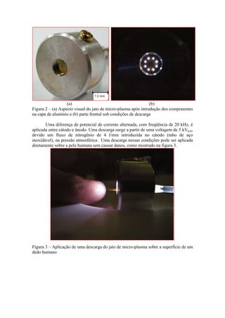 (a)                                          (b)
Figura 2 – (a) Aspecto visual do jato de micro-plasma após introdução dos componentes
na capa de alumínio e (b) parte frontal sob condições de descarga

       Uma diferença de potencial de corrente alternada, com freqüência de 20 kHz, é
aplicada entre cátodo e ânodo. Uma descarga surge a partir de uma voltagem de 5 kVp-p,
devido um fluxo de nitrogênio de 4 l/min introduzida no cátodo (tubo de aço
inoxidável), na pressão atmosférica. Uma descarga nessas condições pode ser aplicada
diretamente sobre a pele humana sem causar danos, como mostrado na figura 3.




Figura 3 – Aplicação de uma descarga do jato de micro-plasma sobre a superfície de um
dedo humano
 