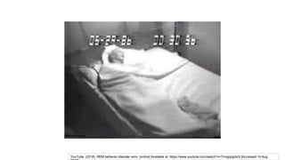 YouTube. (2018). REM behavior disorder.wmv. [online] Available at: https://www.youtube.com/watch?v=TmxgqojpbGI [Accessed 14 Aug.
 