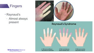 Shiny Fingertips Skin Signs of Scleroderma: A Dermatological Approach to Diagnosis and ...