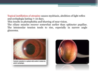 Topical instillation of atropine causes mydriasis, abolition of light reflex
and cycloplegia lasting 7–10 days.
This results in photophobia and blurring of near vision.
The ciliary muscles recover somewhat earlier than sphincter pupillae.
The intraocular tension tends to rise, especially in narrow angle
glaucoma.
 