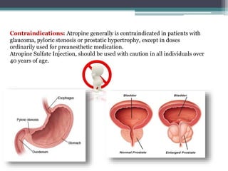 Contraindications: Atropine generally is contraindicated in patients with
glaucoma, pyloric stenosis or prostatic hypertrophy, except in doses
ordinarily used for preanesthetic medication.
Atropine Sulfate Injection, should be used with caution in all individuals over
40 years of age.
 