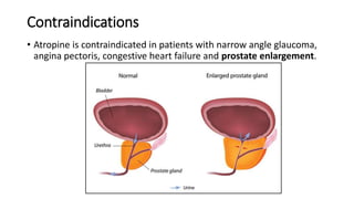 Contraindications
• Atropine is contraindicated in patients with narrow angle glaucoma,
angina pectoris, congestive heart failure and prostate enlargement.
 