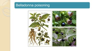 Belladonna poisoning
 