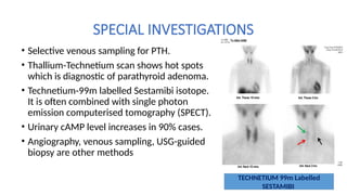 Parathyroid Sampling Hypo and Hyper-parathyroidism-190731100729 (1).pptx