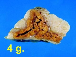 4 g.
 