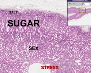 SALT
SUGAR
SEX
STRESSSTRESS
 