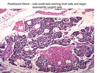 Parathyroid Gland – note small dark staining chief cells and larger,
eosinophilic oxyphil cells
 
