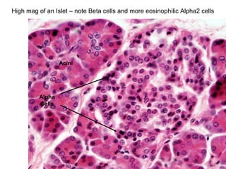 High mag of an Islet – note Beta cells and more eosinophilic Alpha2 cells
Acini
Alpha
Cells
 