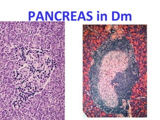 PANCREAS in Dm
 
