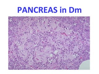 PANCREAS in Dm
 