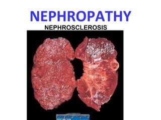 NEPHROPATHY
NEPHROSCLEROSIS
 