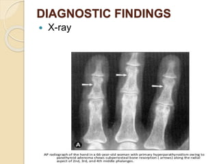 DIAGNOSTIC FINDINGS
 X-ray
 