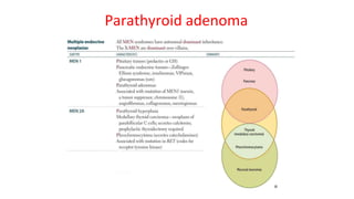 Parathyroid adenoma
 
