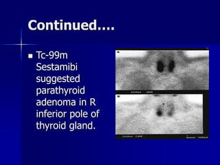 Continued….
 Tc-99m
Sestamibi
suggested
parathyroid
adenoma in R
inferior pole of
thyroid gland.
 