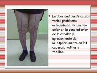  La obesidad puede causar 
varios problemas 
ortopédicos, incluyendo 
dolor en la zona inferior 
de la espalda y 
agravamiento de 
la especialmente en las 
caderas, rodillas y 
tobillos. 
 