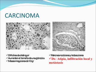 Paratiroides | PPT