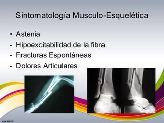 Sintomatología Musculo-Esquelética
• Astenia
- Hipoexcitabilidad de la fibra
- Fracturas Espontáneas
- Dolores Articulares
 