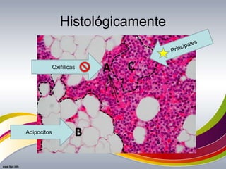 Histológicamente
Oxifílicas
Adipocitos
 