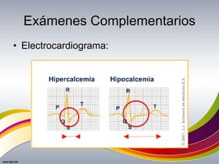 Exámenes Complementarios
• Electrocardiograma:
 