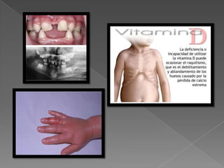 Paratiroides Desarollo y Enfermedades