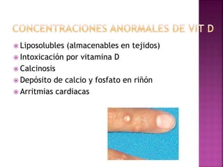  Liposolubles (almacenables en tejidos)
 Intoxicación por vitamina D
 Calcinosis
 Depósito de calcio y fosfato en riñón
 Arritmias cardiacas
 