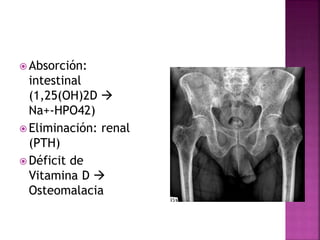  Absorción:
intestinal
(1,25(OH)2D 
Na+-HPO42)
 Eliminación: renal
(PTH)
 Déficit de
Vitamina D 
Osteomalacia
 