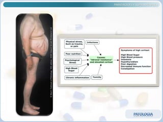 PARATIROIDES Y SUPRARRENALES
 