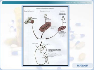 PARATIROIDES Y SUPRARRENALES
 