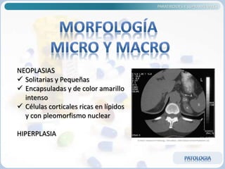 PARATIROIDES Y SUPRARRENALES
NEOPLASIAS
 Solitarias y Pequeñas
 Encapsuladas y de color amarillo
intenso
 Células corticales ricas en lípidos
y con pleomorfismo nuclear
HIPERPLASIA
 
