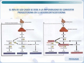 PARATIROIDES Y SUPRARRENALES
 
