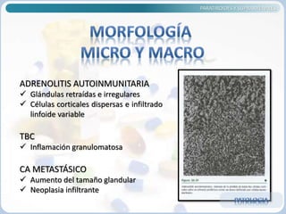 PARATIROIDES Y SUPRARRENALES
ADRENOLITIS AUTOINMUNITARIA
 Glándulas retraídas e irregulares
 Células corticales dispersas e infiltrado
linfoide variable
TBC
 Inflamación granulomatosa
CA METASTÁSICO
 Aumento del tamaño glandular
 Neoplasia infiltrante
 