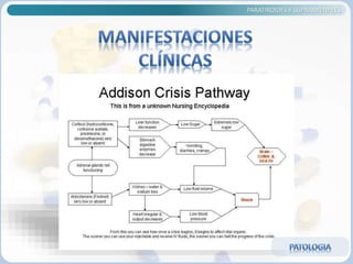 PARATIROIDES Y SUPRARRENALES
 