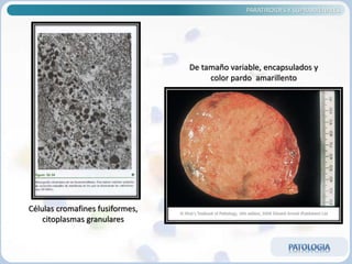 PARATIROIDES Y SUPRARRENALES
De tamaño variable, encapsulados y
color pardo amarillento
Células cromafines fusiformes,
citoplasmas granulares
 